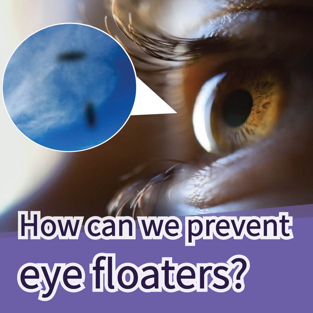 can dogs have floaters in their eyes