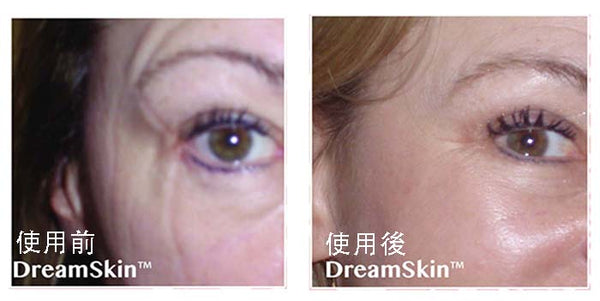 dreamskin pillowcase thread difference