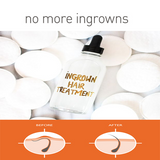 INGROWN HAIR TREATMENTS ~ WAXING COLLECTION