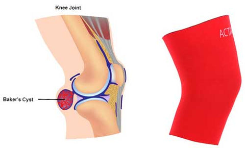 Active650 Knee Support for Bakers Cyst relief