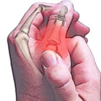 Painful thumb joint remedy