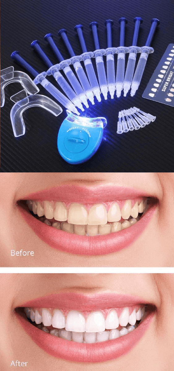 make teeth super white