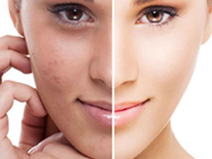 Celebrity Skin Whitening Creams