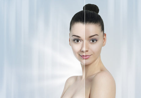 Skin Whitening before and after