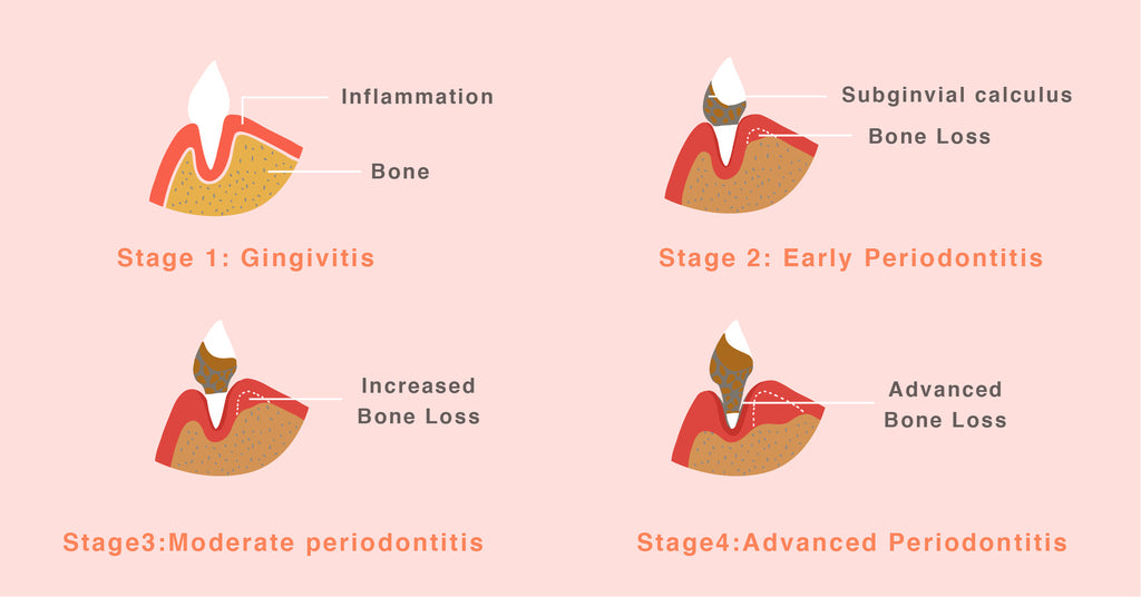dog-periodontal-disease-stage
