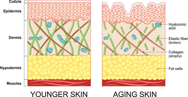 Younger vs older skin comparison