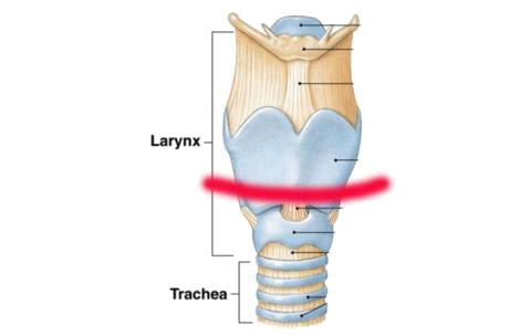 throat strike elasticsteel