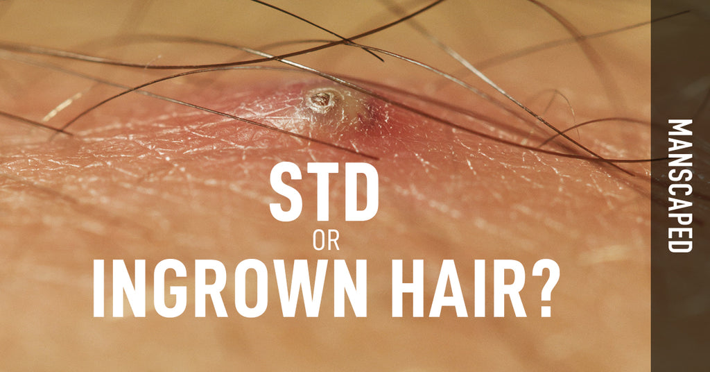 Std Or Ingrown Hair Manscaped