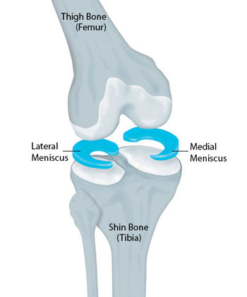 Knee pain meniscus tear and meniscus damage