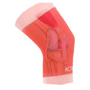 Pain relief for knees from Active650, with extra large knee brace