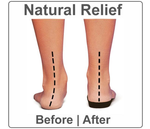 An image showing natural relief for plantar fasciitis