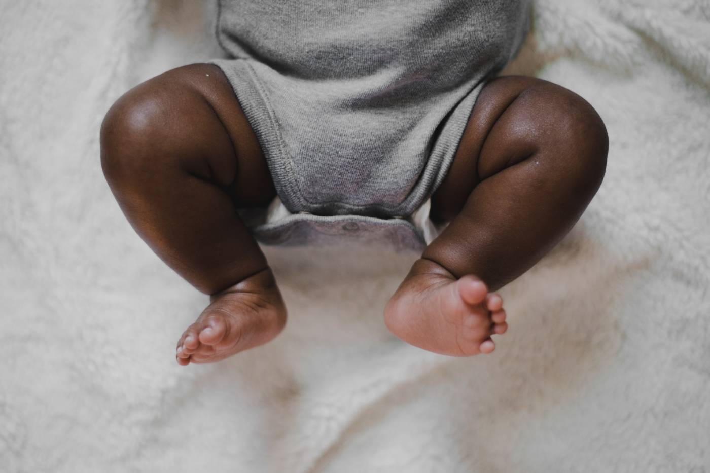 hip displacement in babies