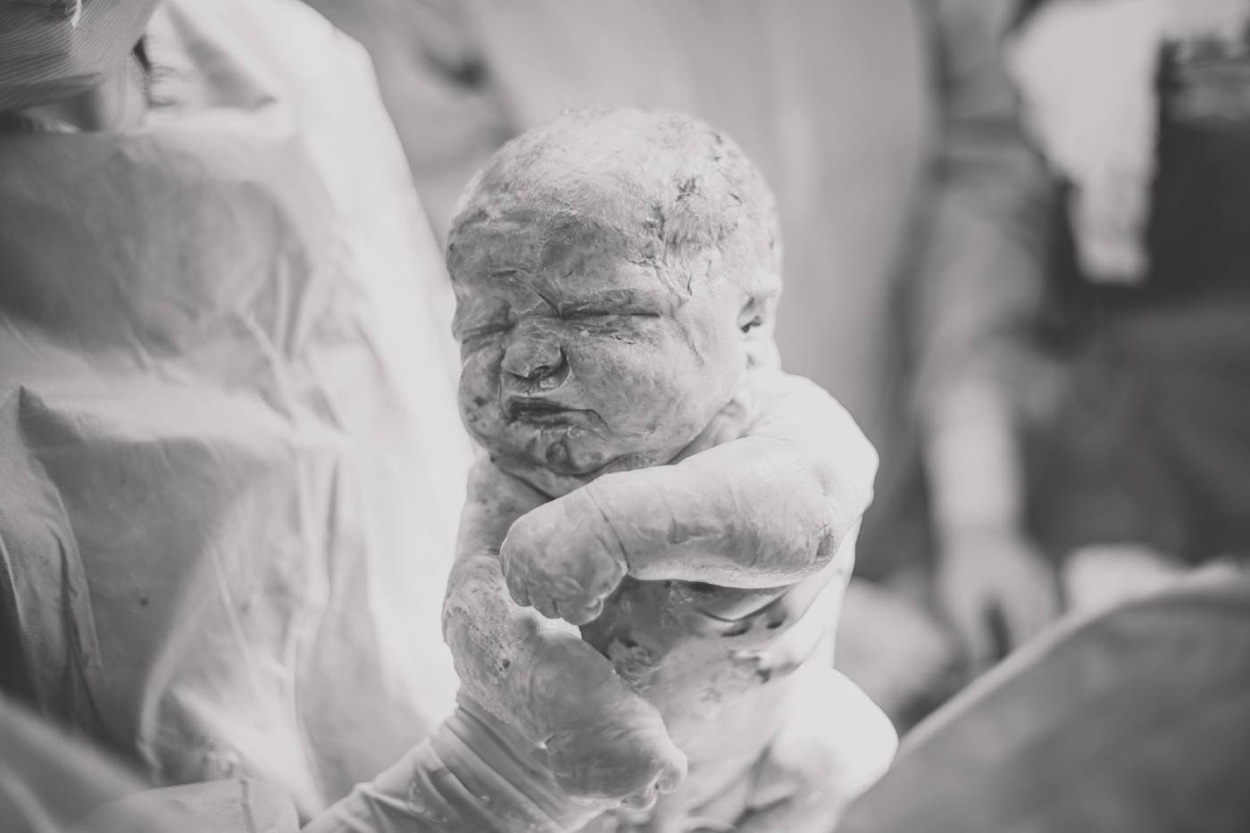 Vernix: What You Need to Know – Happiest Baby