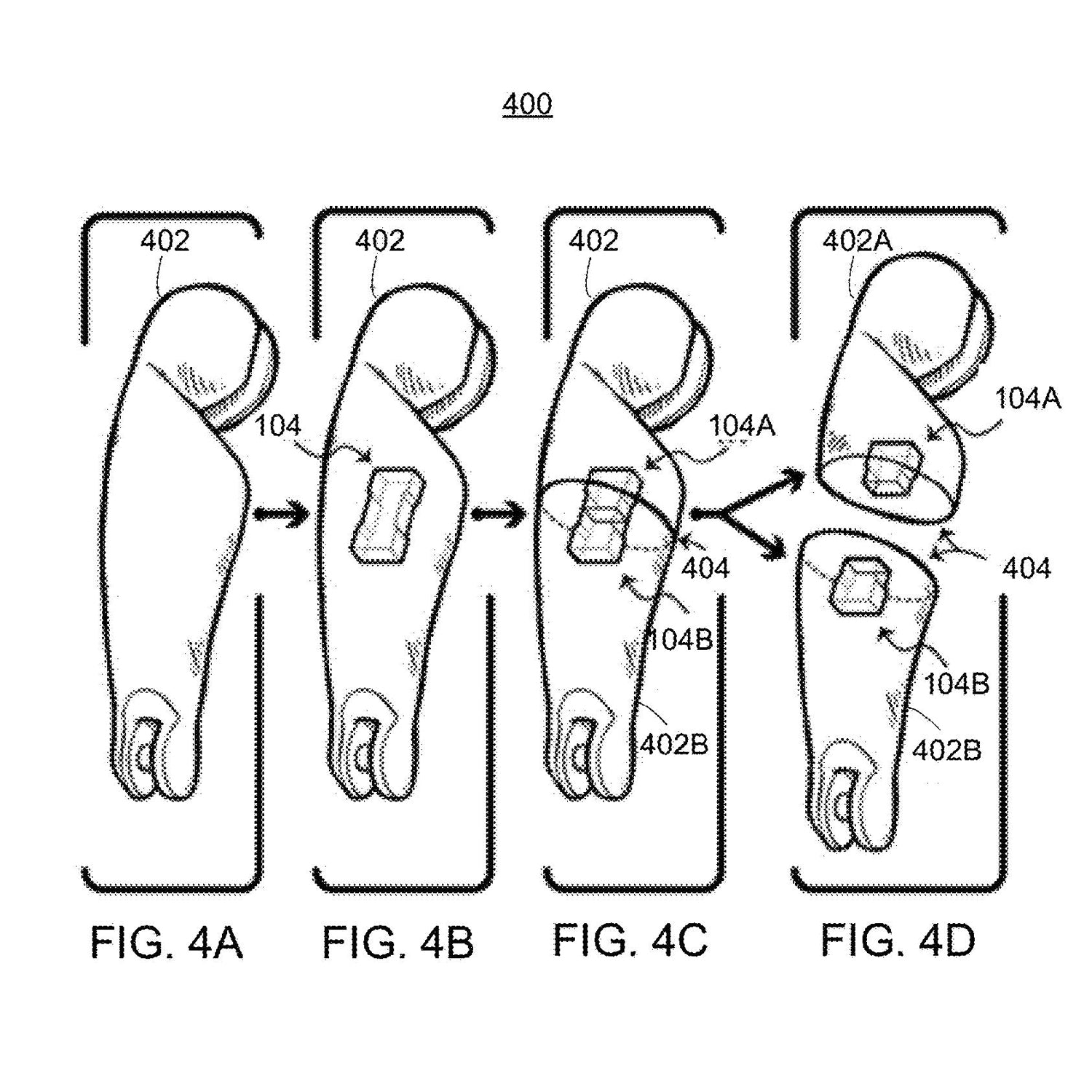 3D Printing Pin System Patent - Doll Thigh - Illustration