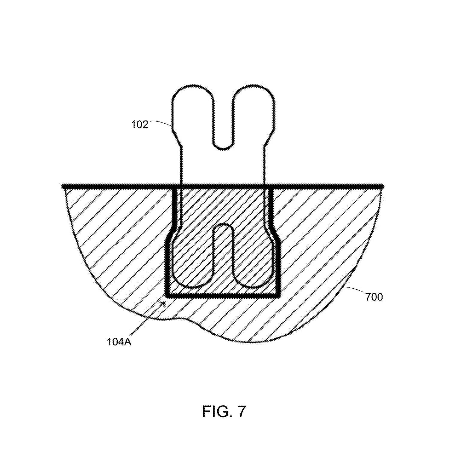3D Printing Patent Illustration - Pin System