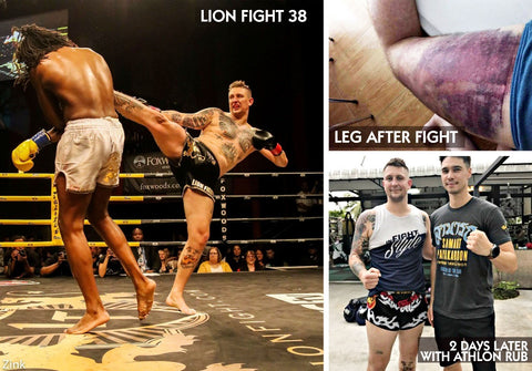 Leg Bruise Recovery - Brett Hlavacek Muay Thai Lion Fight 