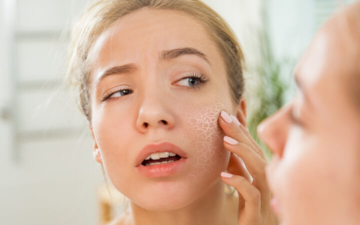 dry skin treatment 7 tips