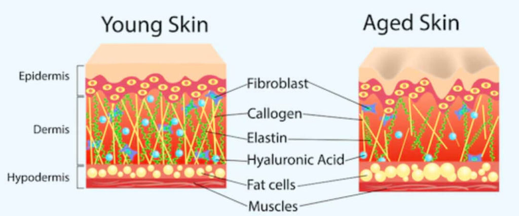 Skin Graph - what happens when you age