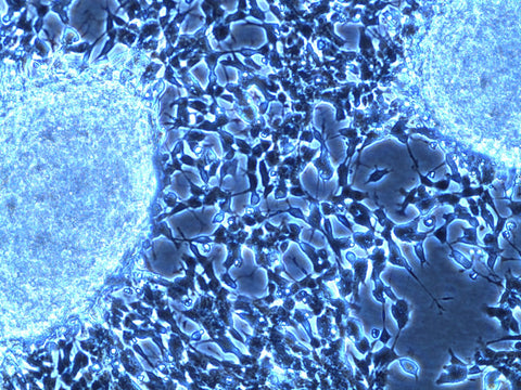 neuroblastoma cell image