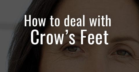 How to deal with Crow's Feet