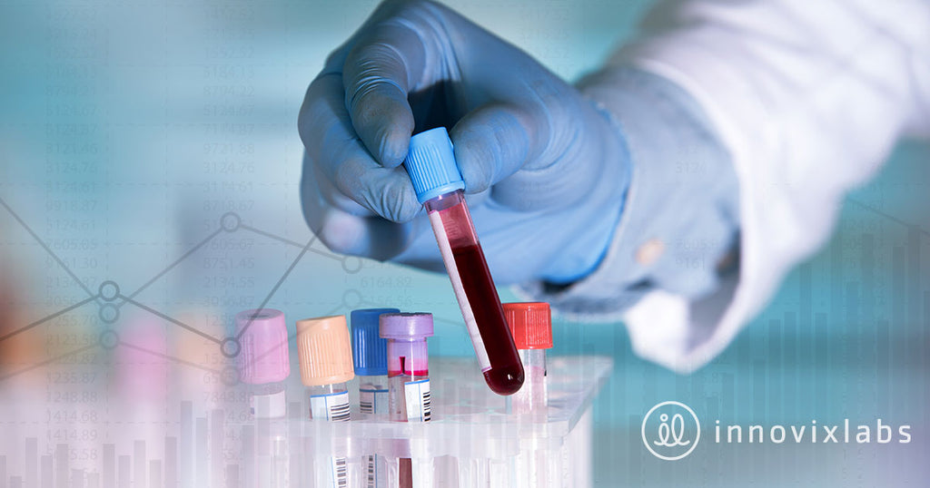 Vitamin K2 blood test