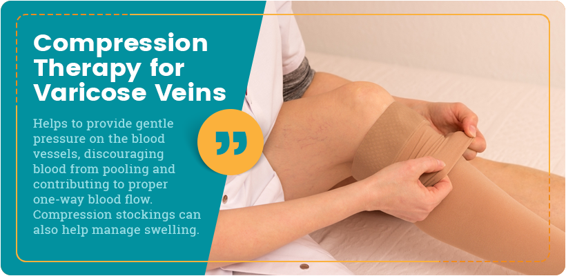 compression therapy for varicose veins quote 