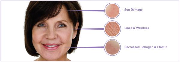 Signs of aging on the skin