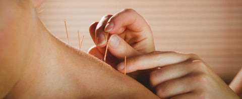 acupuncture for neck and shoulder pain