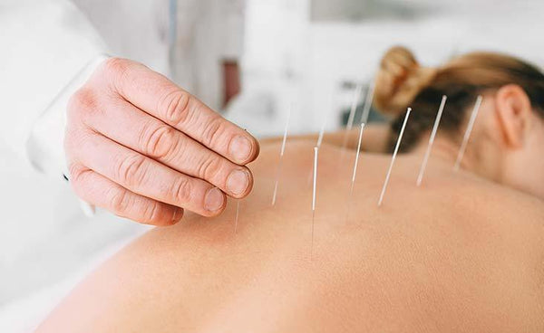 Acupuncture Holisitic Healing