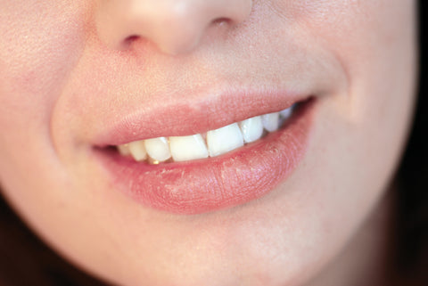 upclose of dry lips