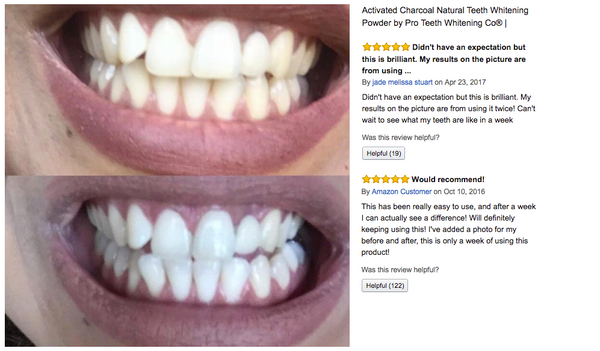 Activated Charcoal Teeth Whitening Results