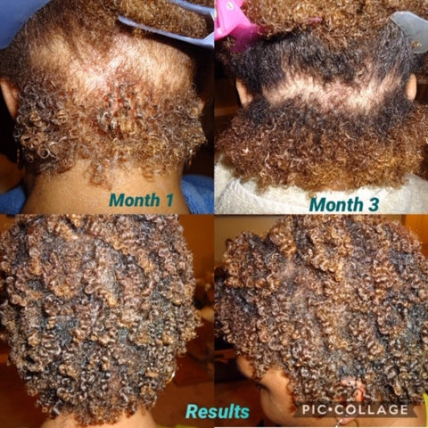 tree naturals curly girl hair growth success story