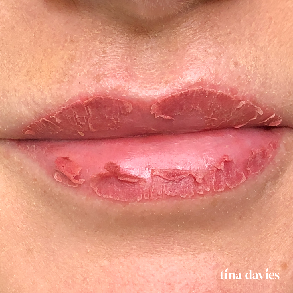 Tina Davies I Love Ink Lip Blush Procedure Healing Process