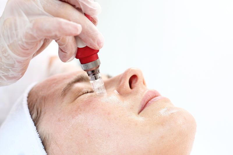 Woman Getting Vampire Facial at Medispa.