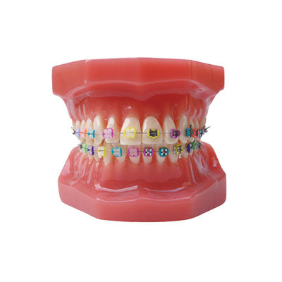 HST-B6-02 Dental Ortho Metal&Ceramic