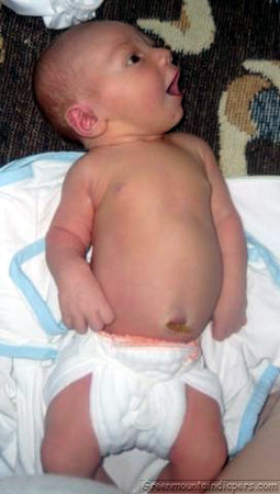 10 pound newborn