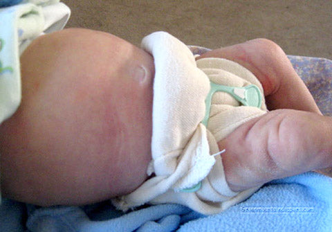 preemie prefold on a baby