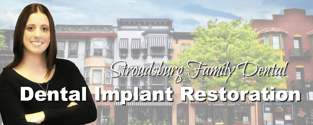 Stroudsburg PA Family Dentistry Dental Implant Restoration