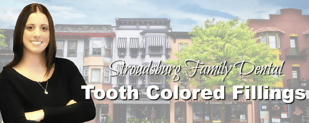 Stroudsburg PA Family Dentistry Tooth Colored Fillings