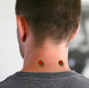 back of a man's head with two red dots at the base of his neck