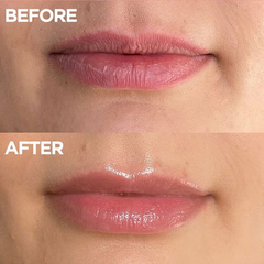 101 Ointment fixes chapped lips