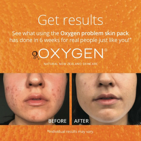problem skin before and after