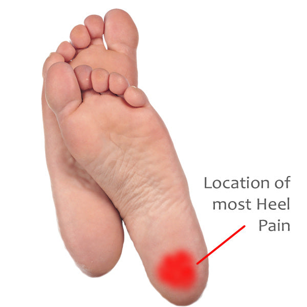 Location for most heel pain