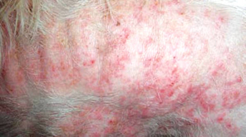 Impetigo chien maladies