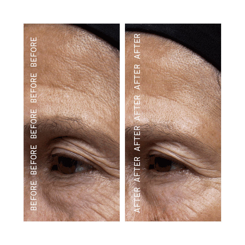 Argan Beta-Retinoid Pink Algae Serum Before and Afters