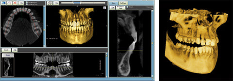 Dental 3D CBCT Systems Rotograph Evo 3D