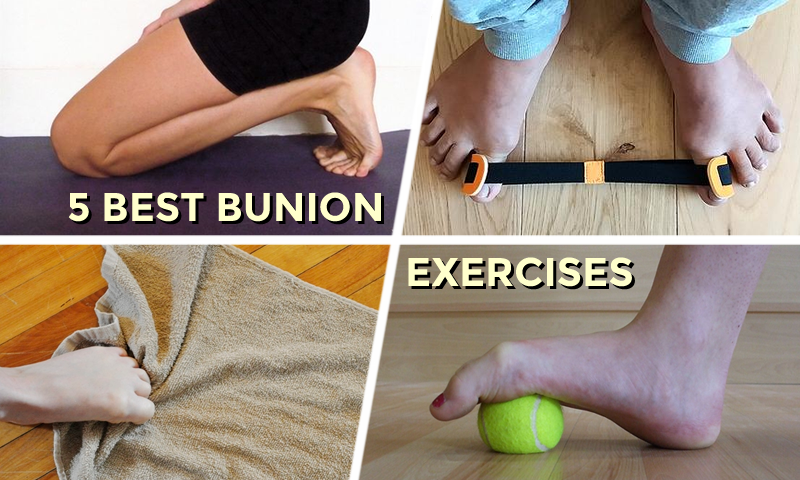 Best Bunion Exercises
