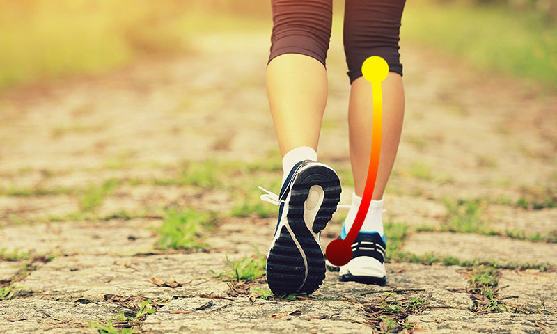 What is Overpronation?