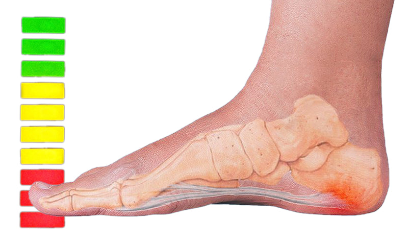 How to Heal Plantar Fasciitis Quickly
