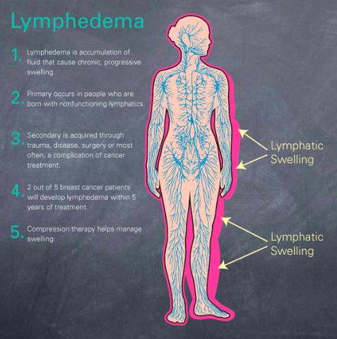 swellnomore reduce lymphedema swelling naturally